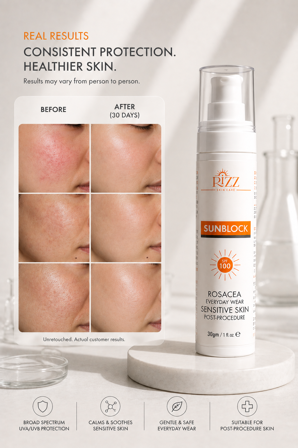 Rizz SPF 100 Sunblock for Sensitive Skin – 30ml